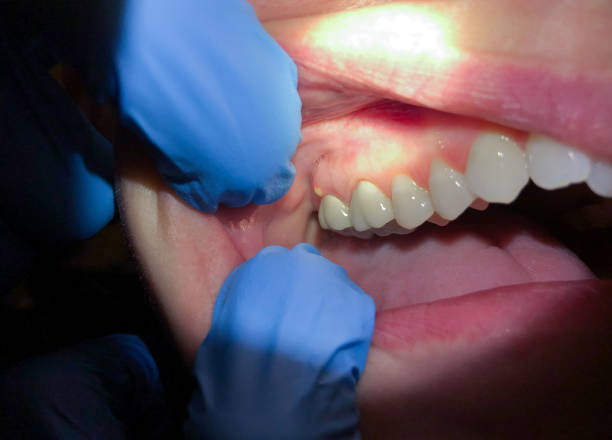 Best Pediatric Emergency Dentist in Centerville, TN
