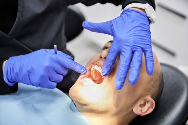 Best Emergency Dental Extractions in Centerville, TN